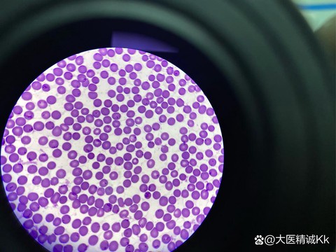 绝地求生紫色血怎么调